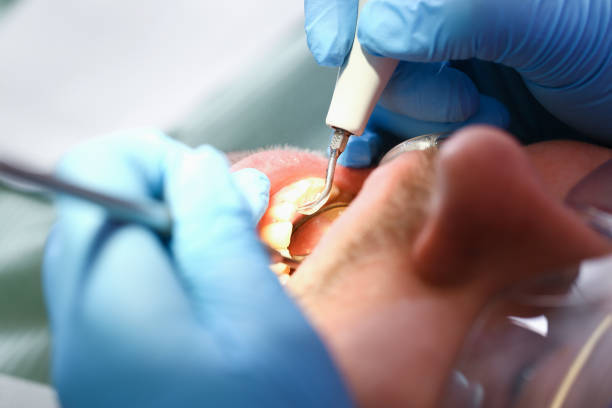 Best Urgent Dental Care for Toothache in Newport, RI